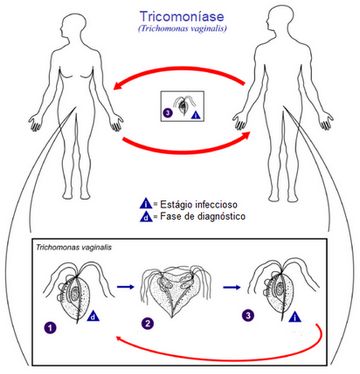 ciclo tricomoniase biologia