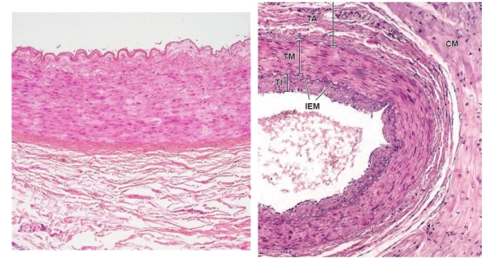 artéria muscular