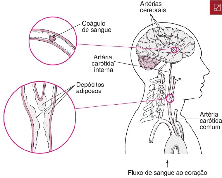 coágulos