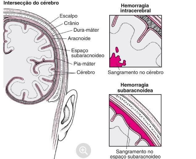 inserções do cérebro