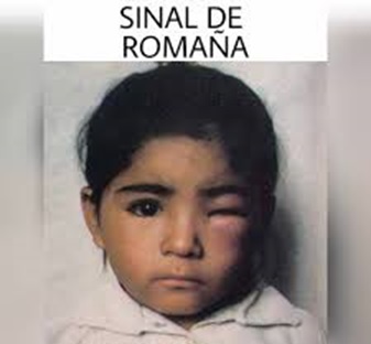 sinal de romaña